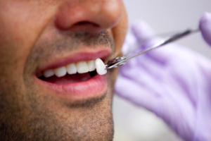 كم تستغرق عملية زراعة الأسنان