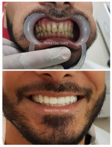 عيادة اسنان في اسطنبول