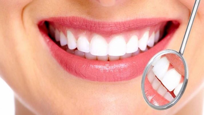 كم تكلف عملية تبييض الأسنان في تركيا